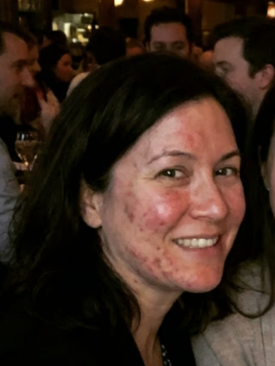Before - Amanda T.