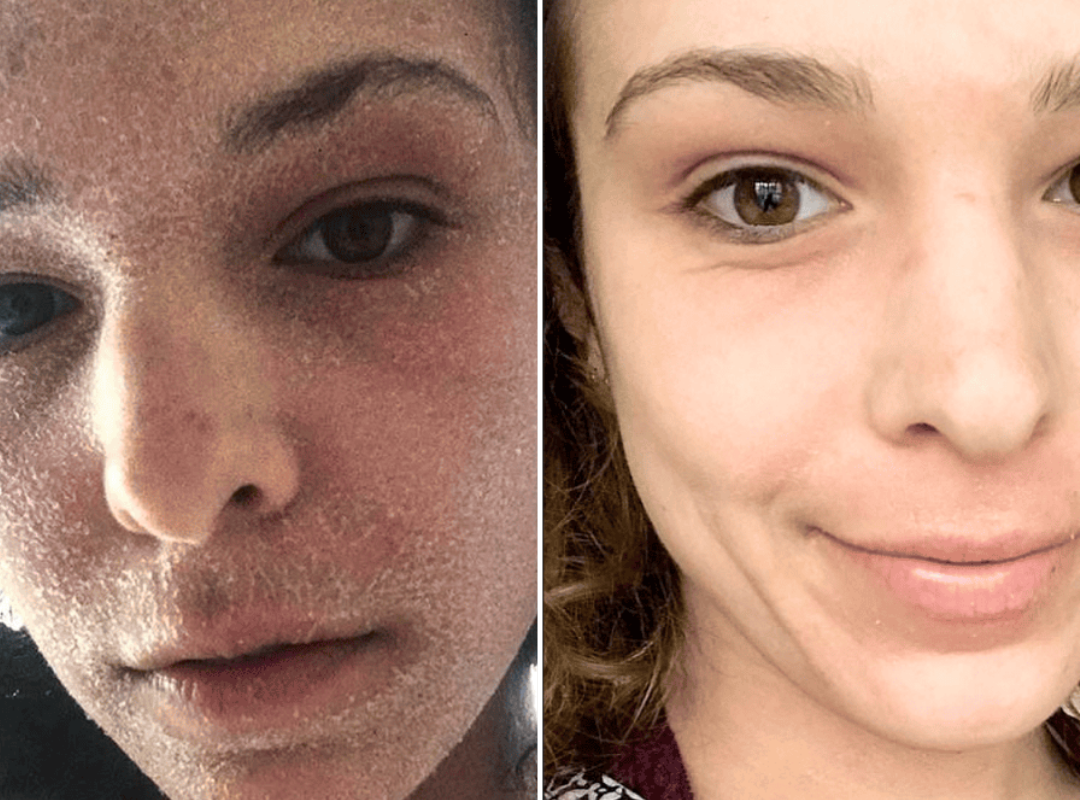 Laura, 33